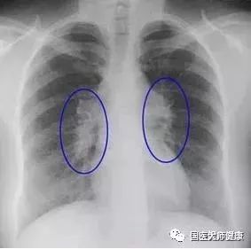 e046ffd41a3ed5493fa7ff4b42be610e.jpg